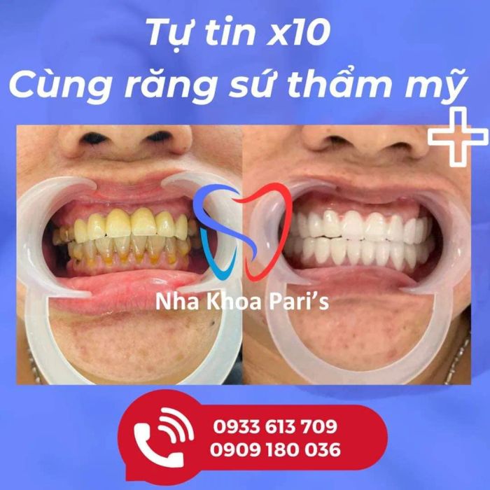 Hình ảnh 2 - Hệ thống phòng điều trị vô trùng đạt chuẩn quốc tế tại Nha khoa Pari's