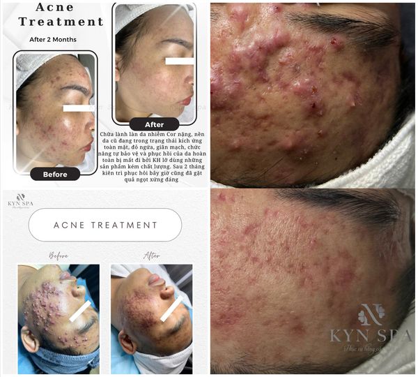 Khoảnh khắc thư giãn tuyệt vời tại Kyn Spa (Kiều Yến Nhi) - Ảnh 3