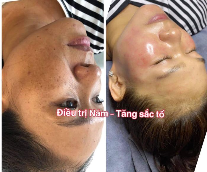 Khoảnh khắc thư giãn tuyệt vời tại Ngân Spa - Ảnh 3