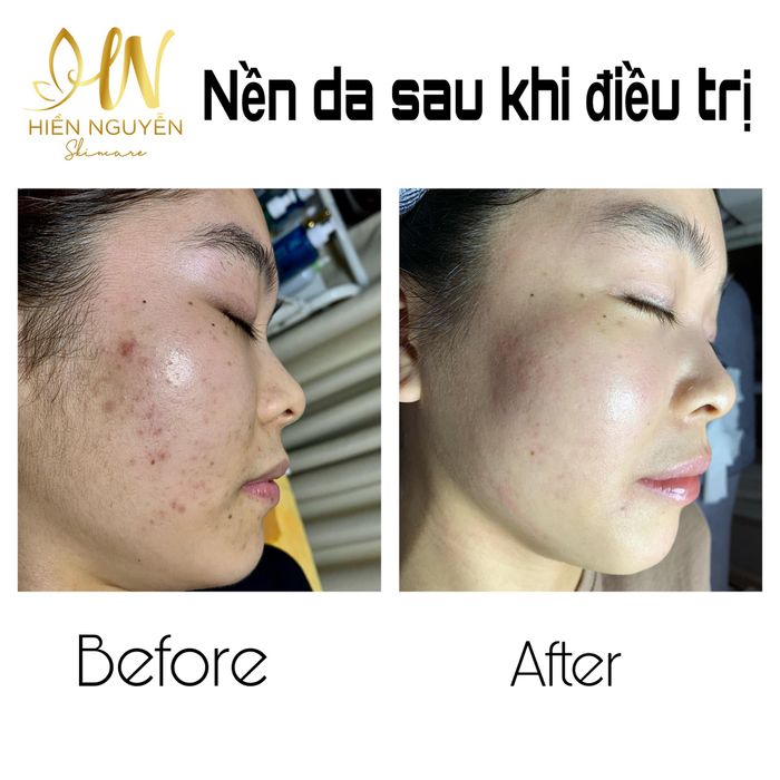 Không gian trị liệu chuyên nghiệp tại Hiền Nguyễn Skincare - Ảnh 1