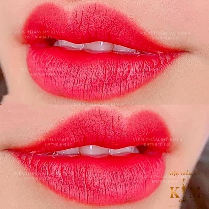 Viện Thẩm Mỹ KJM - Hình ảnh 2