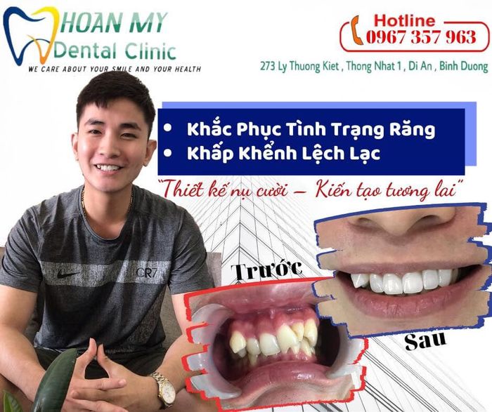 Hình ảnh Nha Khoa Hoàn Mỹ Dental