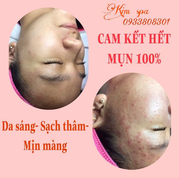 Không gian sang trọng và hiện đại tại Kim Beauty Spa - Ảnh 1