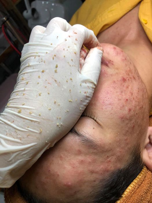 Quy trình chăm sóc da cao cấp tại Spa Thùy Dương - Ảnh 2