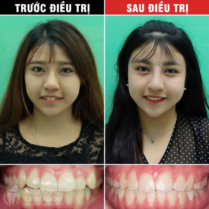 Hệ thống trang thiết bị tiên tiến của Nha Khoa Linh Xuân