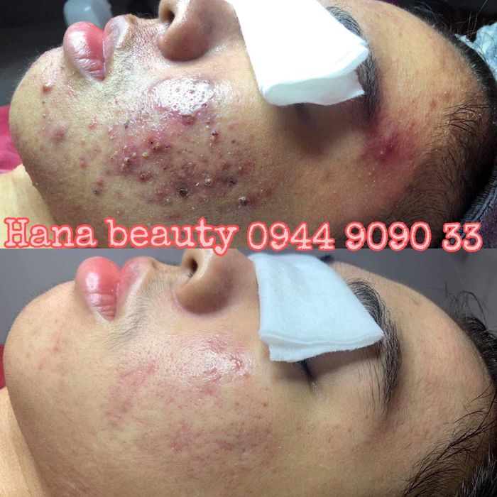 Không gian thư giãn đẳng cấp tại HANA Beauty Spa & Cosmetic - Ảnh 3