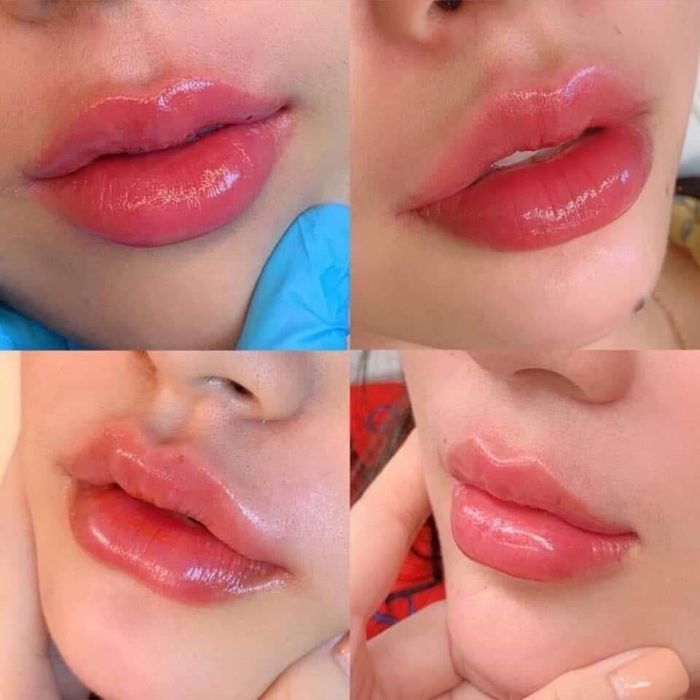 Cỏ Spa hình ảnh 2