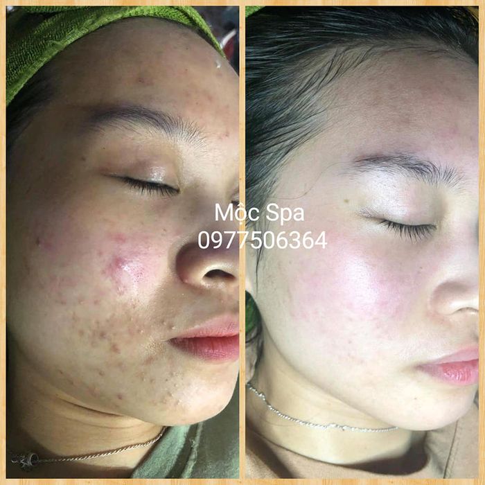 Trang Spa - Hòa Bình