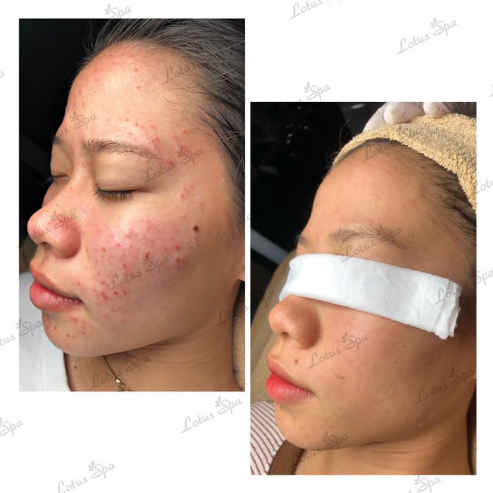 Trải nghiệm dịch vụ cao cấp tại Lotus Spa - Ảnh 3