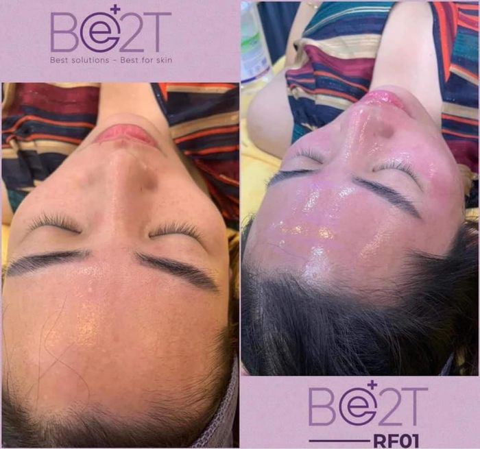 Thẩm mỹ Bác sĩ Hằng - Hòa Bình