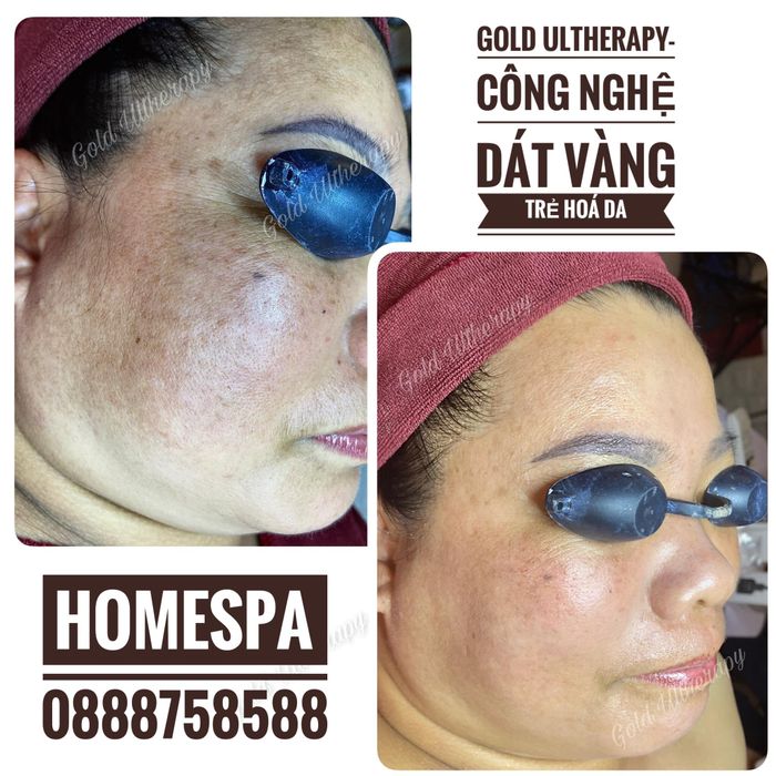 Home Spa - Hình ảnh 2