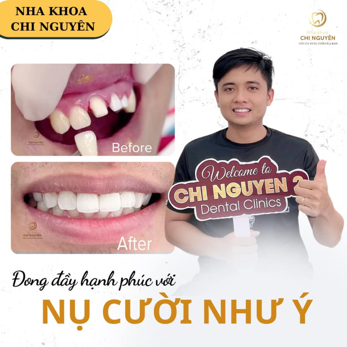 Nha Khoa Chi Nguyên - Hình ảnh 1