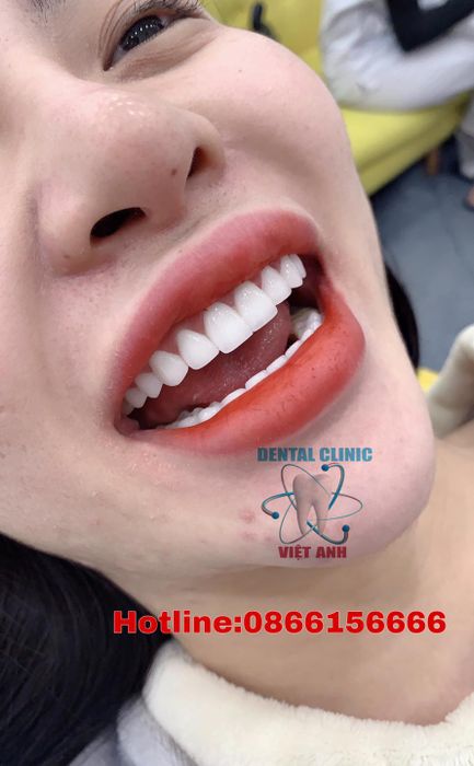Hệ thống trang thiết bị tiên tiến của Nha Khoa Việt Anh