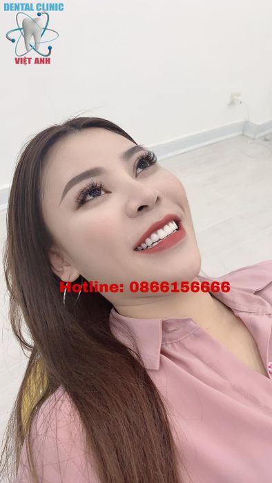 Không gian hiện đại tại Nha Khoa Việt Anh