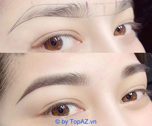 Địa chỉ thẩm mỹ viện uy tín bậc nhất tại Trà Vinh