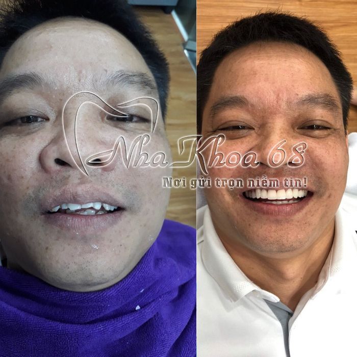 Không gian hiện đại và chuyên nghiệp tại Nha Khoa 68