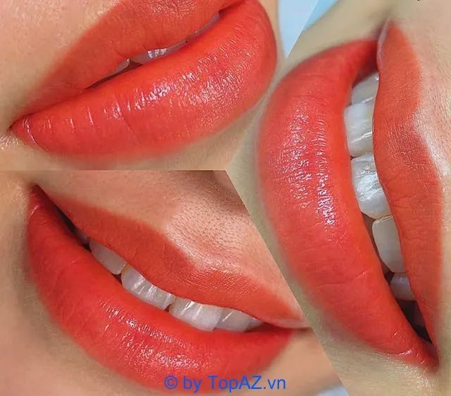 Địa chỉ thẩm mỹ vàng tại Trà Vinh