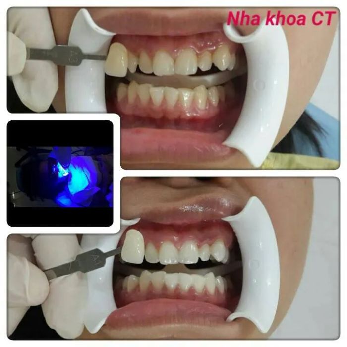 Nha Khoa CT - Phòng khám uy tín tại Tân Uyên