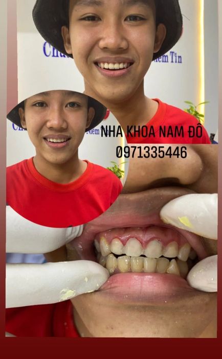 Nha Khoa Nam Đô - Cơ sở nha khoa chất lượng tại Tân Uyên (Ảnh 2)