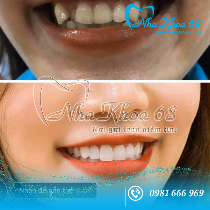 Hình ảnh cơ sở vật chất hiện đại tại Nha Khoa 68