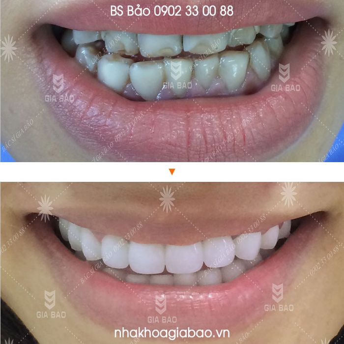 Hình ảnh Nha Khoa Gia Bảo - Không gian khám chữa bệnh sang trọng