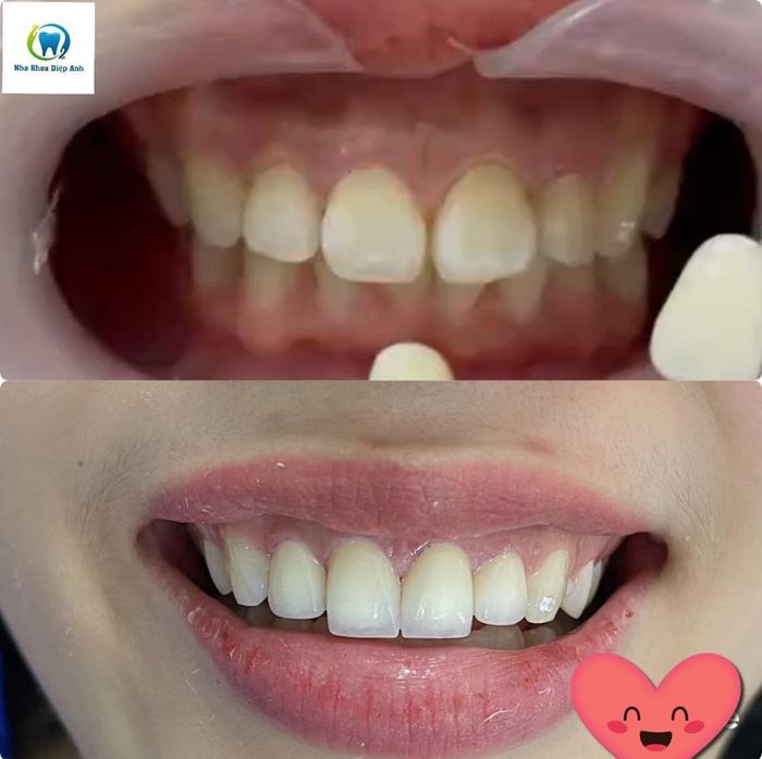 Hệ thống phòng khám hiện đại tại Nha Khoa Diệp Anh