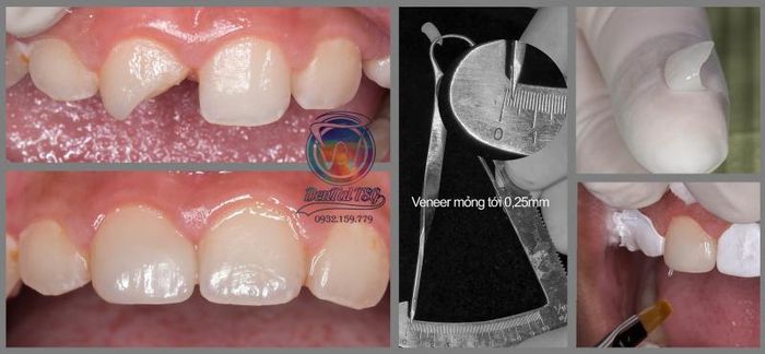 Hình ảnh thực tế về hệ thống phòng khám và dịch vụ chuyên nghiệp tại TSG Dental