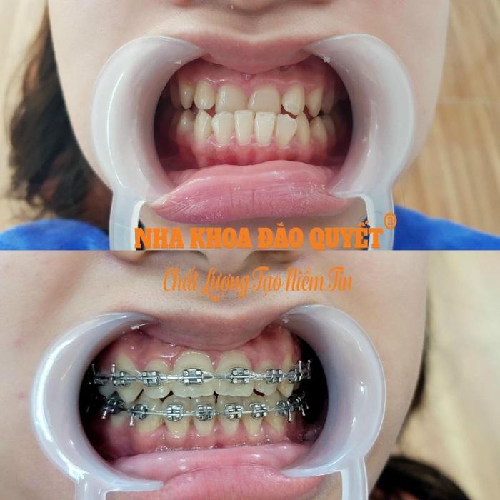 Hình ảnh Nha Khoa Đào Quyết
