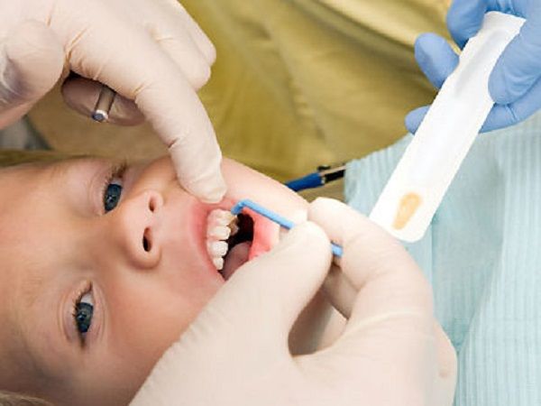 Bộ sưu tập hình ảnh thực tế về quy trình điều trị chuẩn quốc tế tại Nha Khoa Nụ Cười