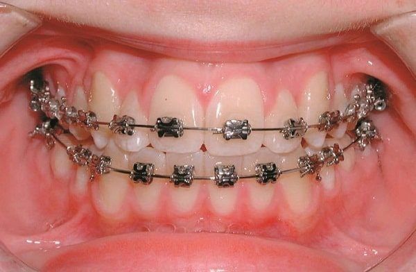 Khám phá không gian hiện đại và dịch vụ chuyên nghiệp tại Nha Khoa Nụ Cười qua loạt ảnh chất lượng