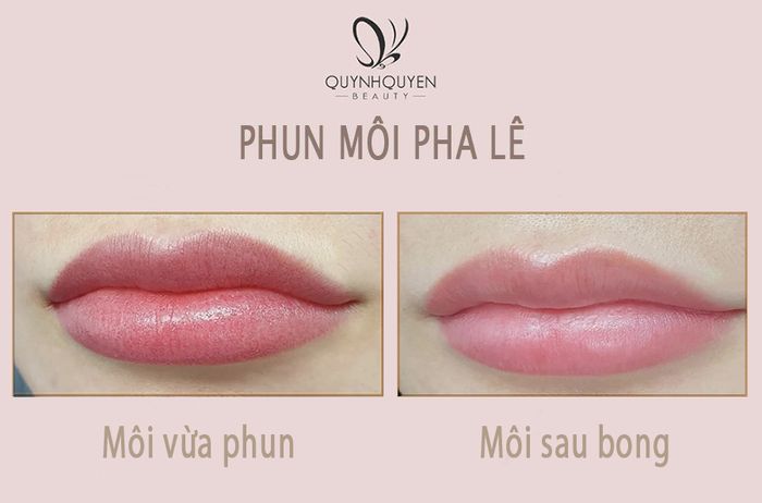 Hình ảnh Trung tâm Thẩm mỹ Quỳnh Quyên