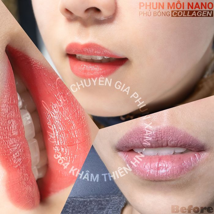 Hình ảnh Thẩm mỹ Cao Linh