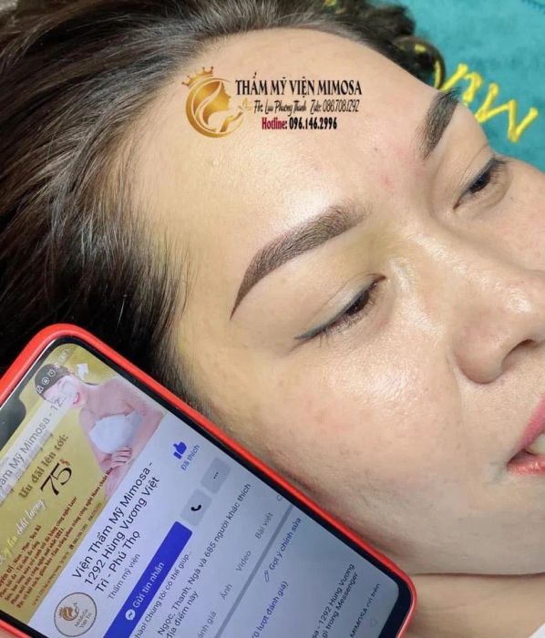 Hình ảnh Thẩm mỹ viện Mimosa 1
