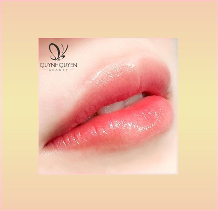 Hình ảnh Trung tâm Thẩm mỹ Quỳnh Quyên 2