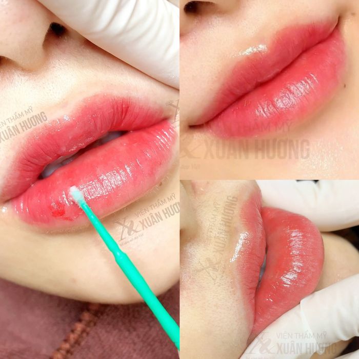 Hình ảnh Viện Thẩm Mỹ Xuân Hương 2