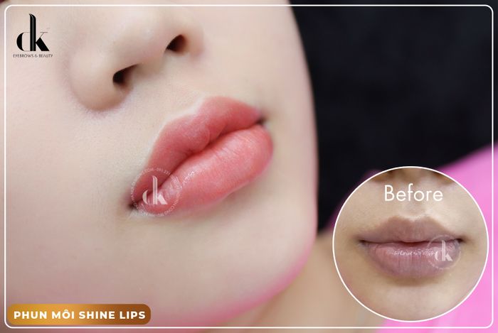Hình ảnh DK Beauty 1