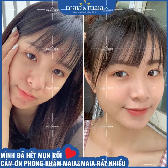 Hình ảnh Phòng Khám Da Liễu Maia