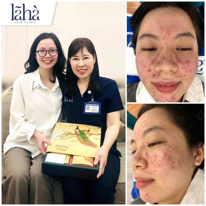 BS Lã Hà tại phòng khám Lã Hà Skin Clinic