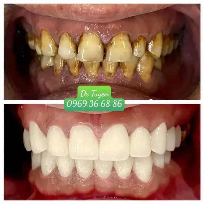 Hình ảnh Nha Khoa Phương Anh – Góc nhìn thứ hai đầy ấn tượng