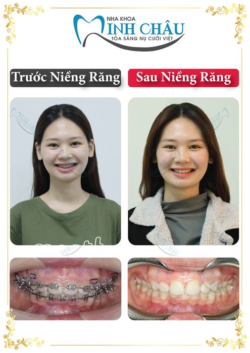 Hình ảnh Nha Khoa Minh Châu – Không gian thân thiện và chuyên nghiệp (góc 1)