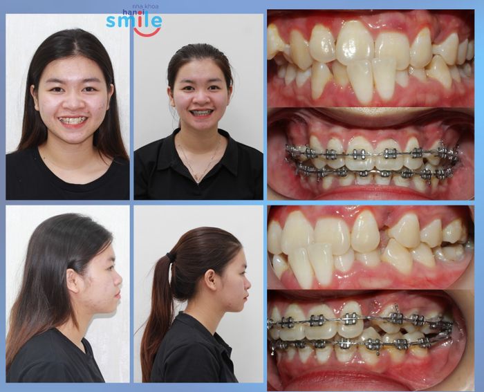 Hình ảnh Nha Khoa Hanoi Smile – Không gian hiện đại, dịch vụ tận tâm (góc 1)
