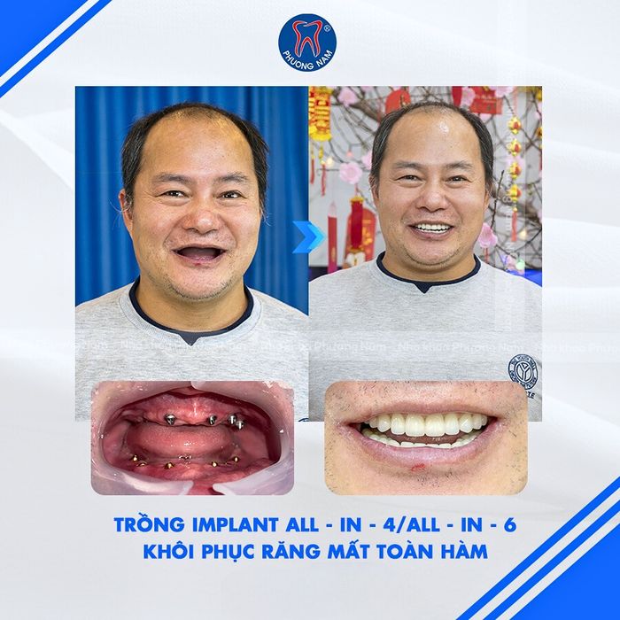 Hình ảnh phòng khám Nha Khoa Phương Nam – Góc nhìn số 2