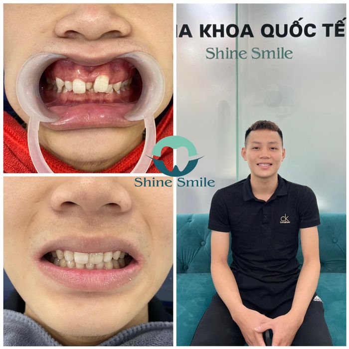 Hình ảnh Nha Khoa Quốc Tế Shine Smile 1