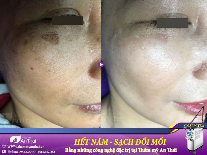 Hệ thống máy móc công nghệ cao tại Thẩm Mỹ An Thái