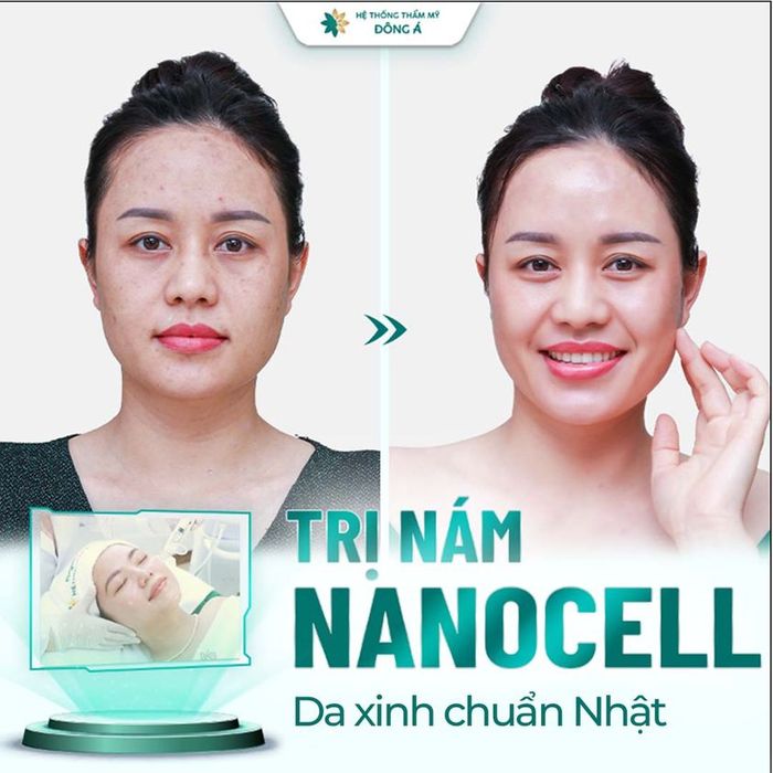 Hình ảnh Thẩm Mỹ Viện Đông Á - Không gian sang trọng