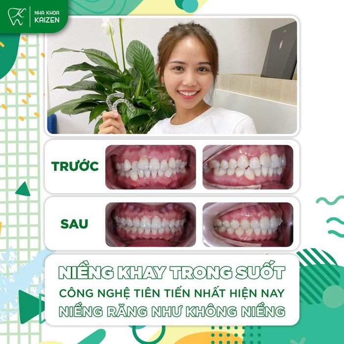 Hình ảnh Nha Khoa Kaizen – Không gian chuyên nghiệp và tinh tế (góc 1)