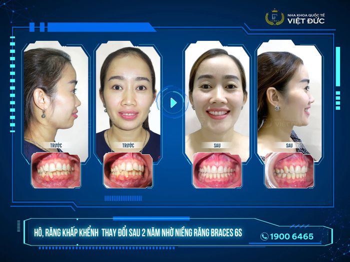 Nha Khoa Quốc Tế Việt Đức - Hình ảnh 2