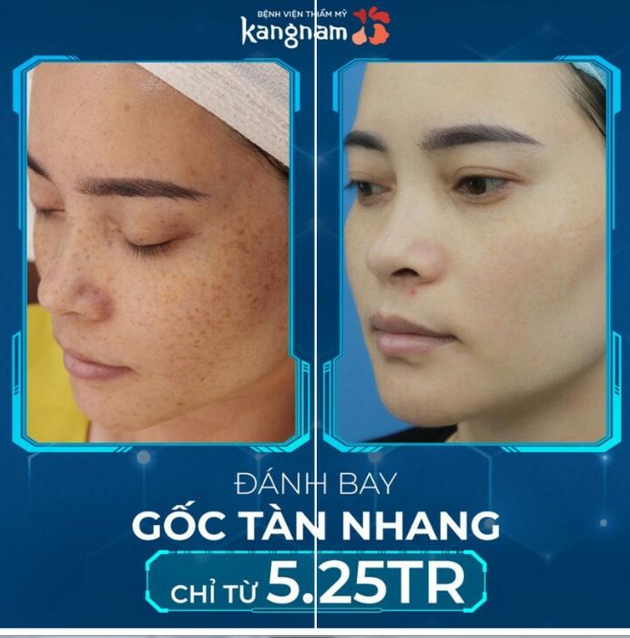 Hình ảnh Bệnh viện Thẩm mỹ Kangnam