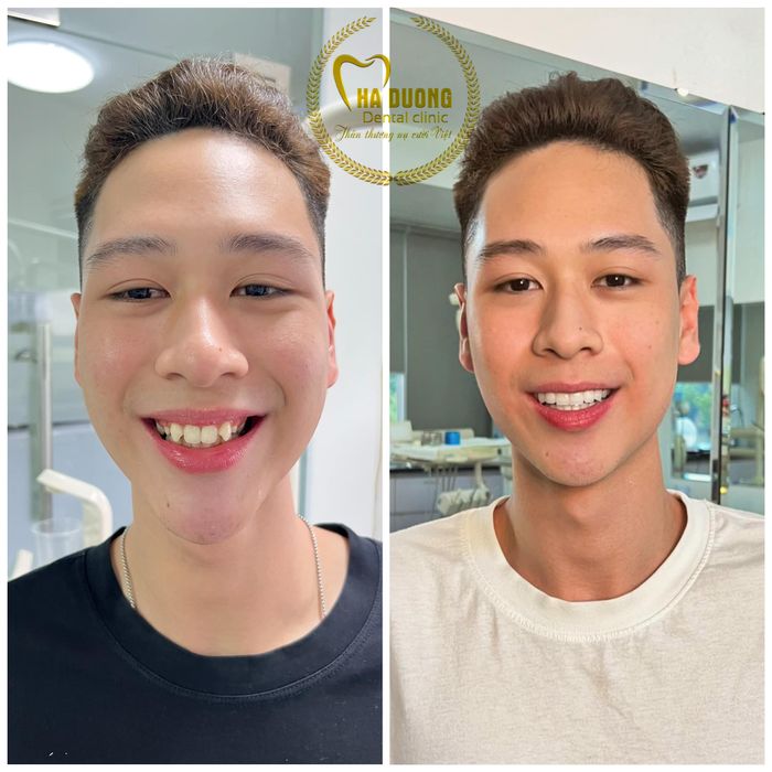 NHA KHOA HÀ ĐƯƠNG hình ảnh 2