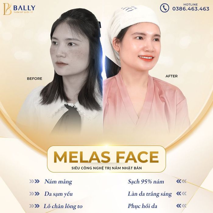 Hình ảnh không gian sang trọng tại Thẩm Mỹ Quốc Tế Bally
